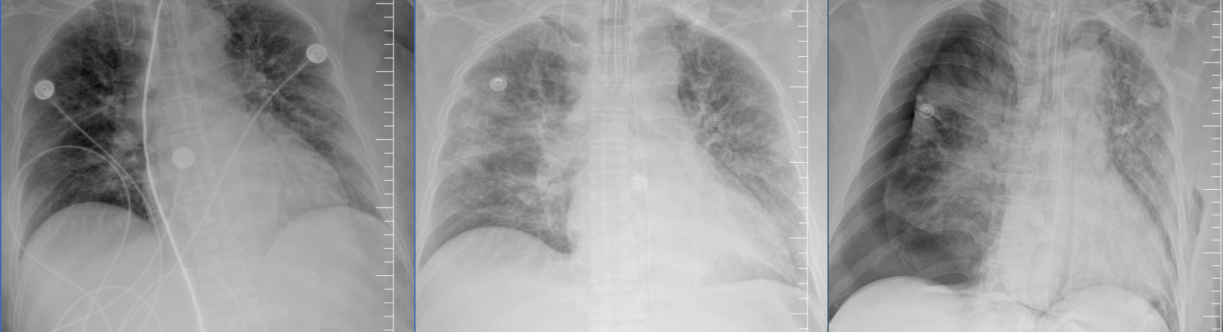 DR